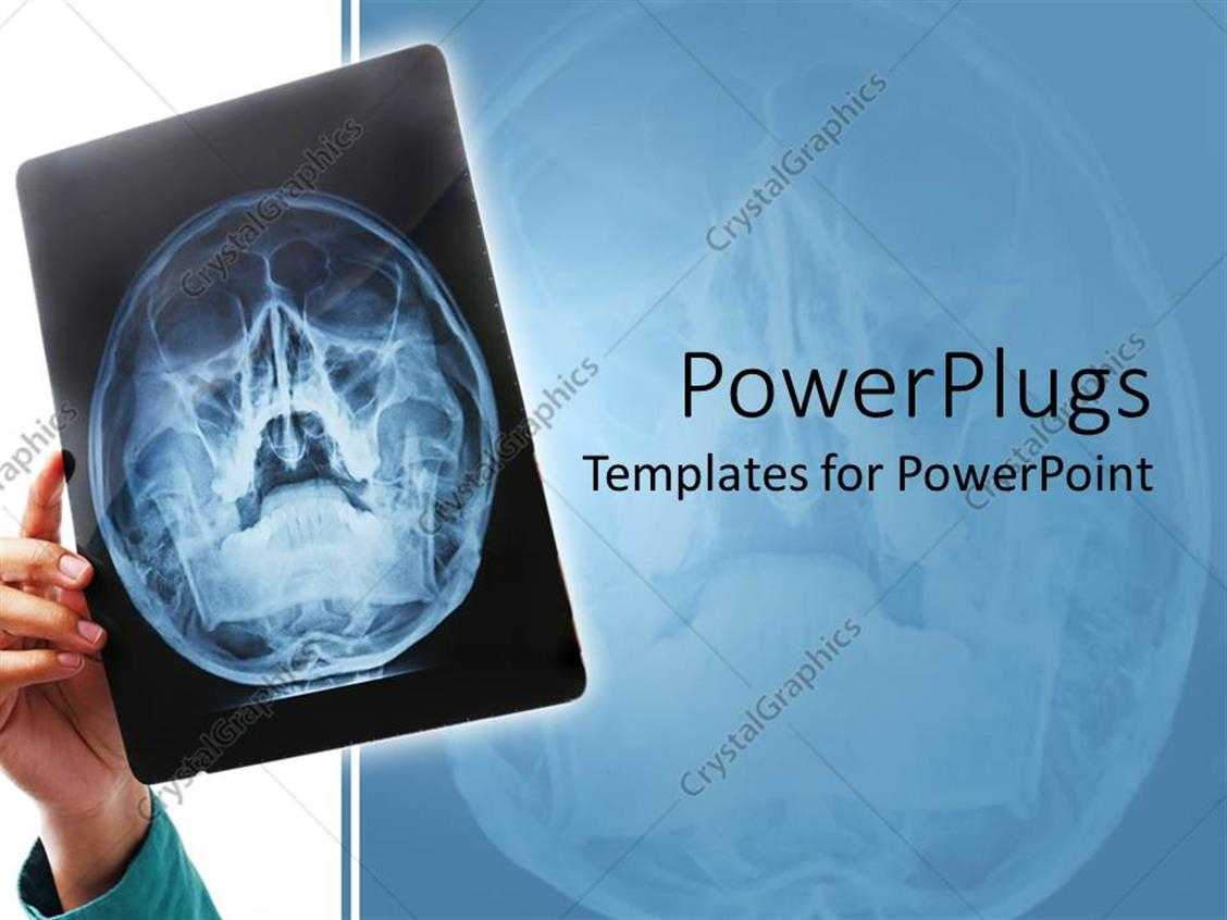 Powerpoint Template: Hand Holding Up X Ray Scan Of Human For Radiology Powerpoint Template